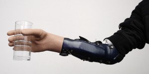 Une main bionique aussi forte qu’une main greffée 